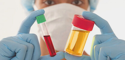 diagnosticos laboratoriais famesp curso de analises clinicas