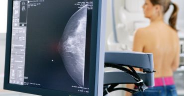 curso de especializacao tecnico em mamografia