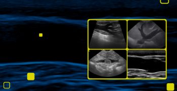 Extenso---Ultrassonografia-Vascular-CAPA-CURSO