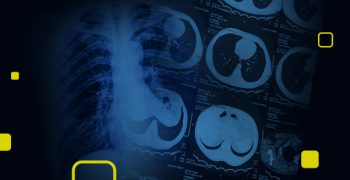 Extensão - Noções básicas de Raio X e Tomografia computadorizada_capa